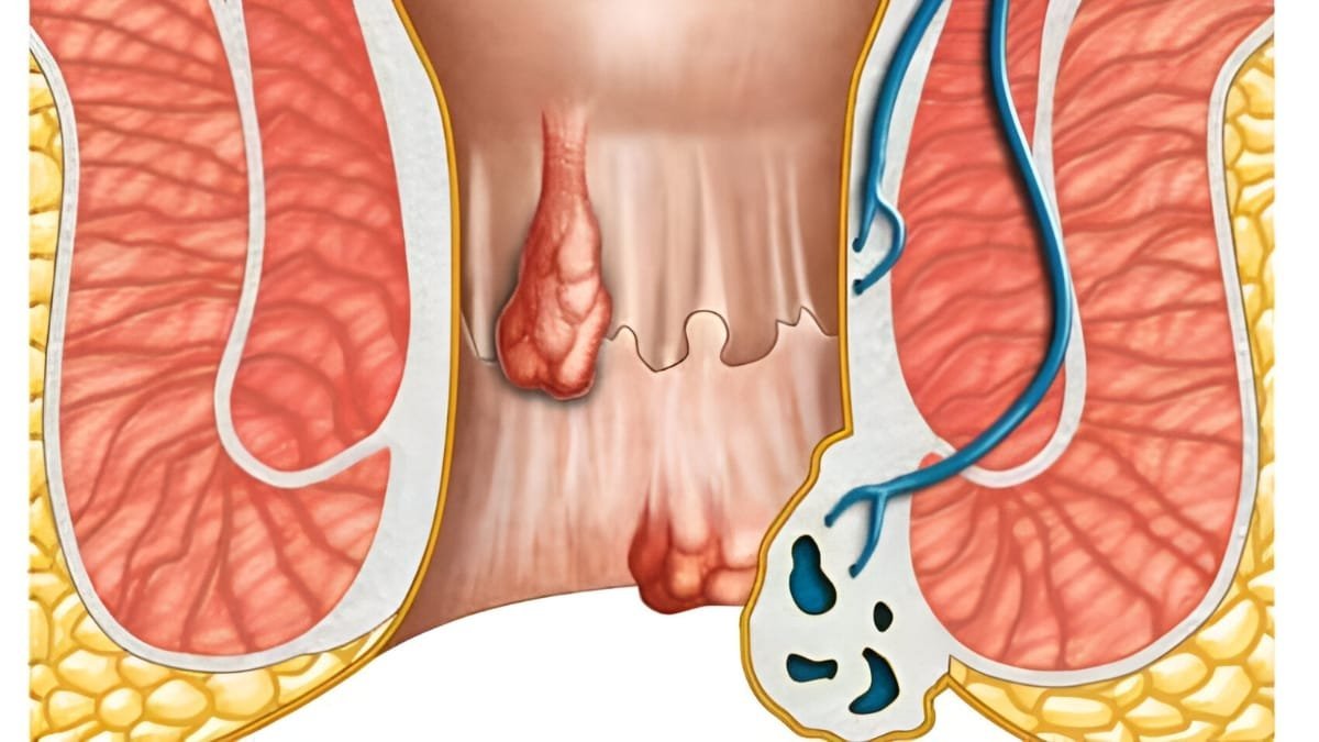 Untitled-design-2024-11-11T164532.883